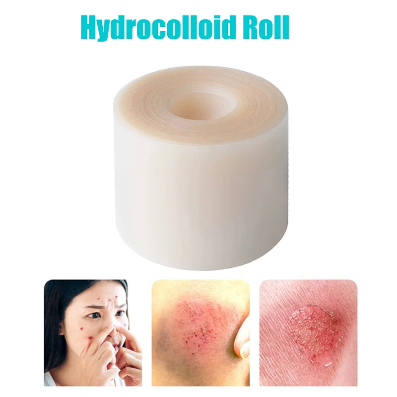 Hydrocolloid Roll for Wound Care – Self-Adhesive Bandage for Burns & Bed Sores